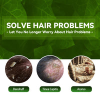Shampoo EELHOE de Limpieza Profunda y Control de Grasa