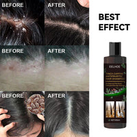 Shampoo EELHOE de Limpieza Profunda y Control de Grasa